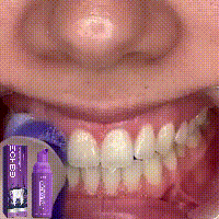 EELHOE Purple Corrector Deeply Clean Tartar Very Well Tartar Yellow Teeth Care For Oral Health Care