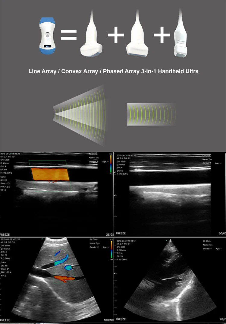 New Arrival Clinic Hospital Use Portable Ultrasound Scanner Machine Portable Ultrasound Scanner Color Doppler Device