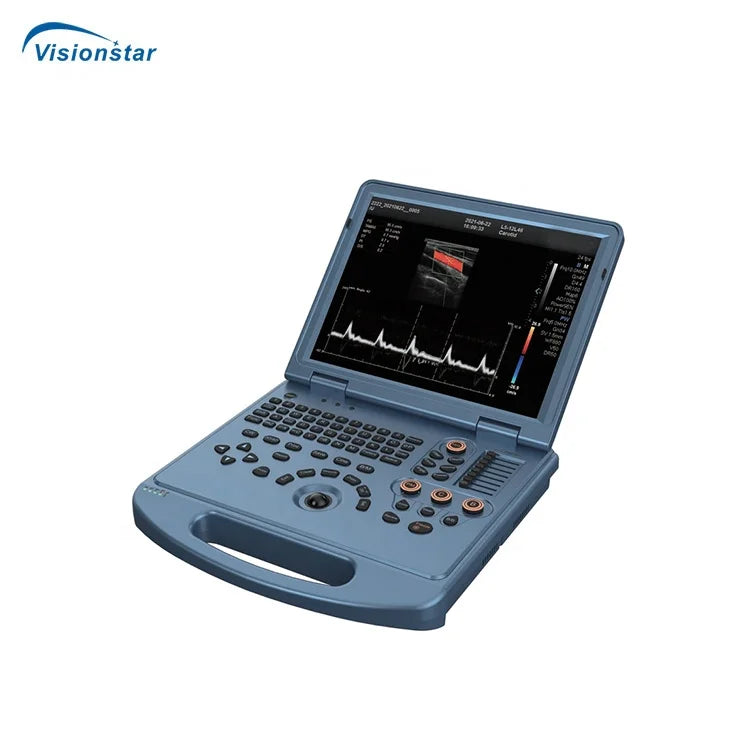UCD5L Hospital Diagnosis Scanner Laptop Color Doppler 3D 4D Ultrasound Machine for Pregnancy