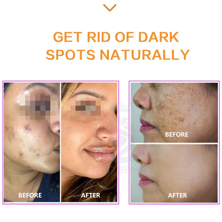 Multifunctional dark spot corrector Korean skincare PDRN solution hydrating and firming to repair damaged skin