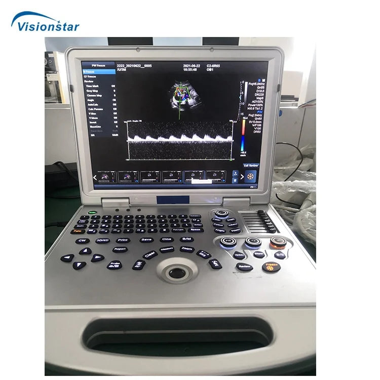 UCD5L Hospital Diagnosis Scanner Laptop Color Doppler 3D 4D Ultrasound Machine for Pregnancy