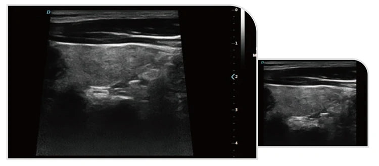 UCD5L Hospital Diagnosis Scanner Laptop Color Doppler 3D 4D Ultrasound Machine for Pregnancy
