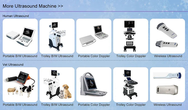 UCD5L Hospital Diagnosis Scanner Laptop Color Doppler 3D 4D Ultrasound Machine for Pregnancy