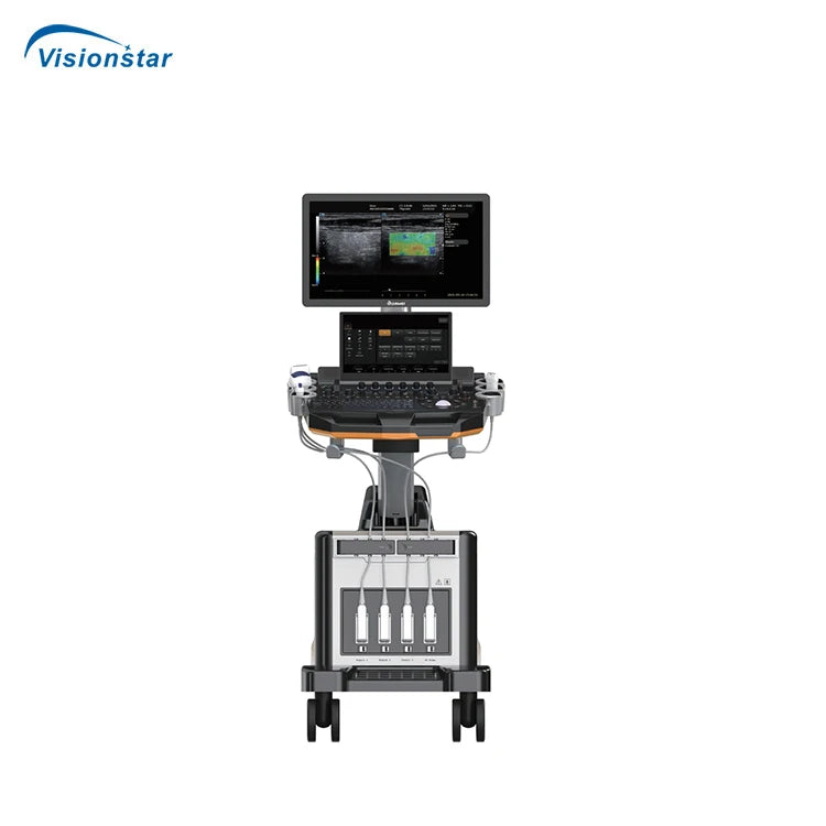 UCD60T Professional Cardiac Imaging Color Doppler 5D Trolley Ultrasound Machine for Hospital