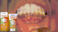 Oralhoe Oral Care Toothpaste Clean Teeth Remove Stains Care For Oral Health Environment Care Toothpaste