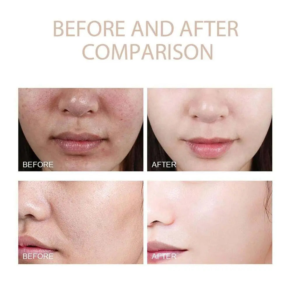 Exfoliating Toner, Natural Rice Extract, Gentle Hydration, Black Rice Ampoule 80ml Deep Skincare Solution