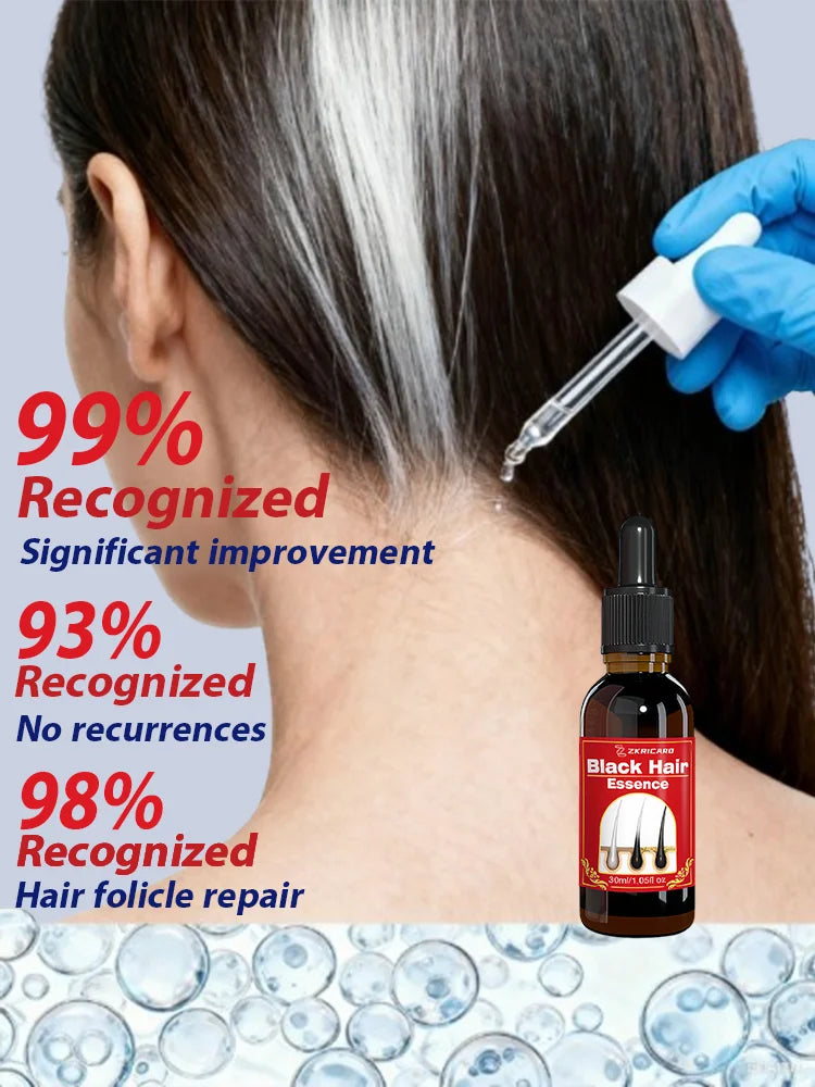 White to Black Hair Serum Gʀᴀʏ Hᴀɪʀ Tʀᴇᴀᴛᴍᴇɴᴛ Nᴀᴛᴜʀᴀʟ Cᴏʟᴏʀ Rᴇᴘᴀɪʀ Nᴏᴜʀɪsʜɪɴɢ Aɴᴛɪ-Hᴀɪʀ Lᴏss Cᴀʀᴇ Mᴇɴ Wᴏᴍᴇɴ