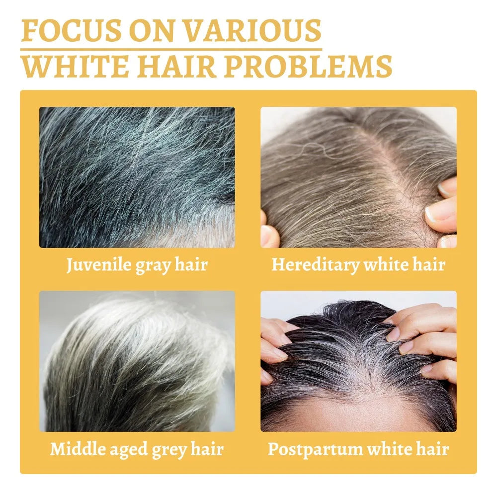 Nourishing the scalp, light and non-greasy, it is a must-have for gray-haired people and meets the needs of most people