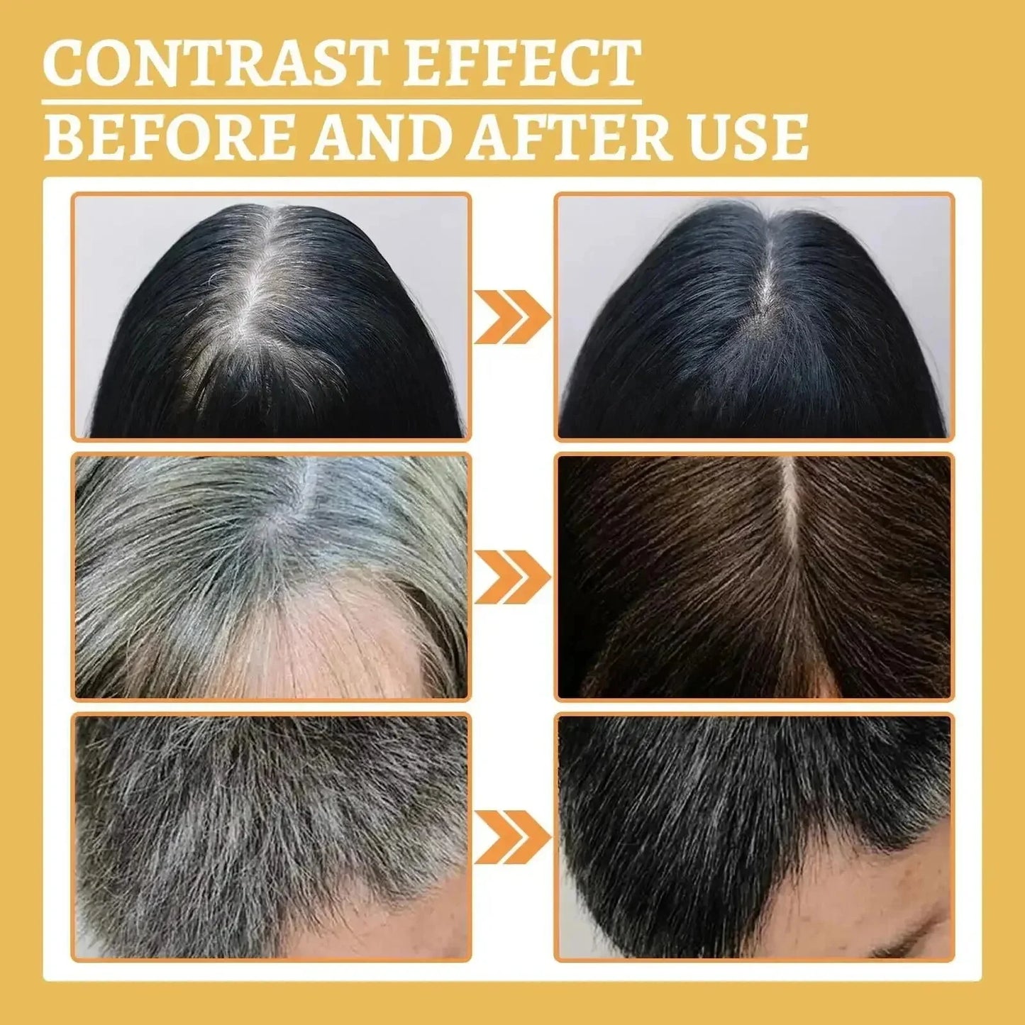 Natural Anti Gray Hair Serum | Nourishing Hair Care Remedy - Repair White & Darkening Hair