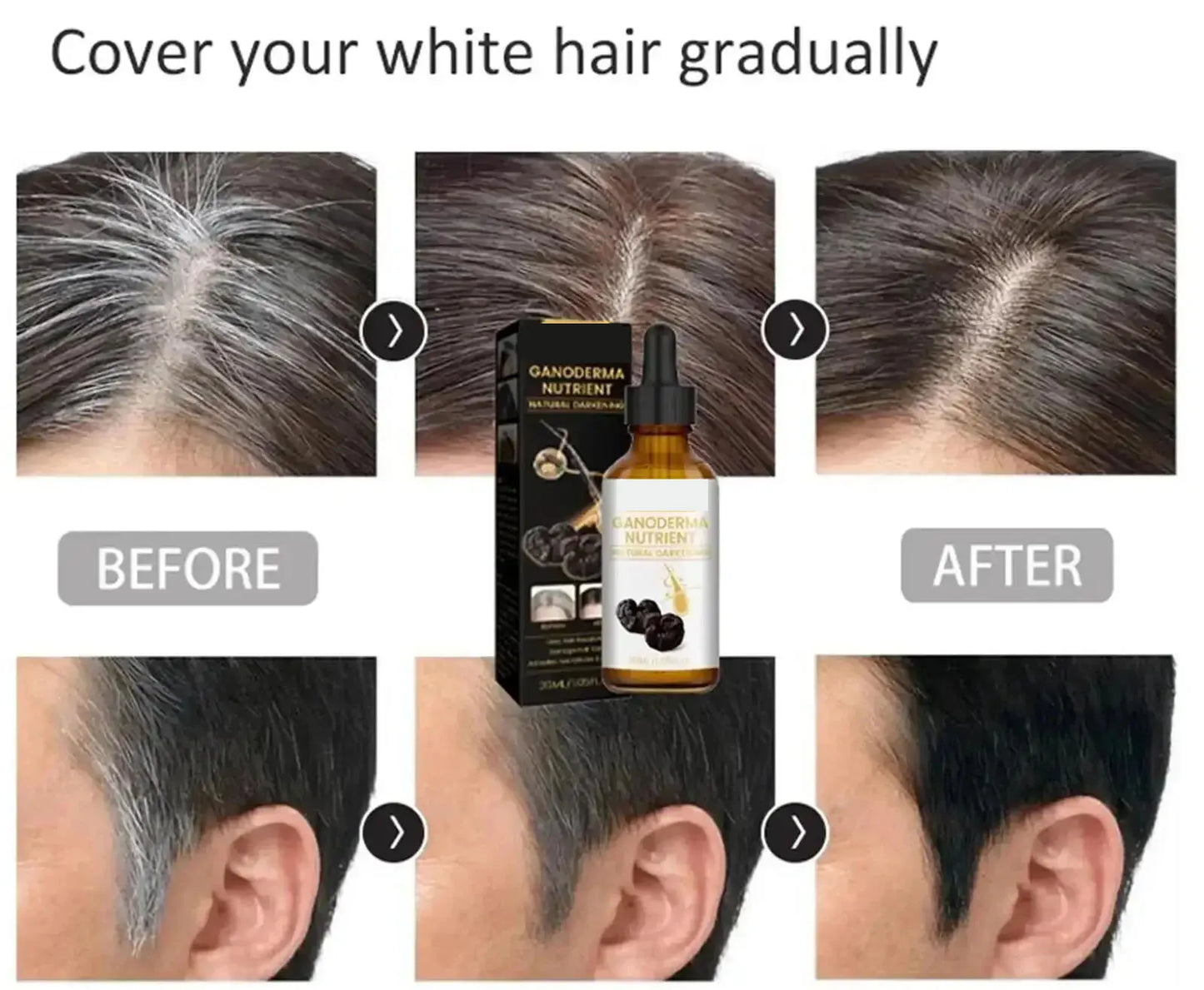 Natural Anti Gray Hair Serum | Nourishing Hair Care Remedy - Repair White & Darkening Hair