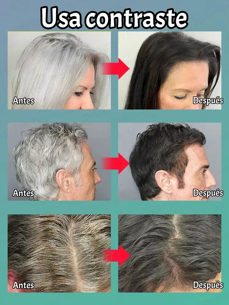 Natural antigen serum: Recover dark hair within 7 days and prevent 98% gray hair appearance - Plant extract