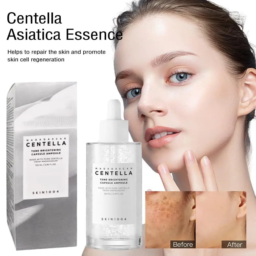 Original Skin1004 Centella Asiatica Serum Relieve Dryness Moisturizing Ampoule Essence For Sensitive Skin, Acne Skin Face Care
