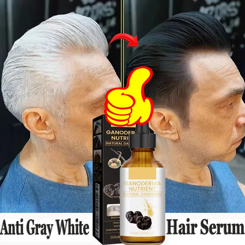Natural Anti Gray Hair Serum | Nourishing Hair Care Remedy - Repair White & Darkening Hair