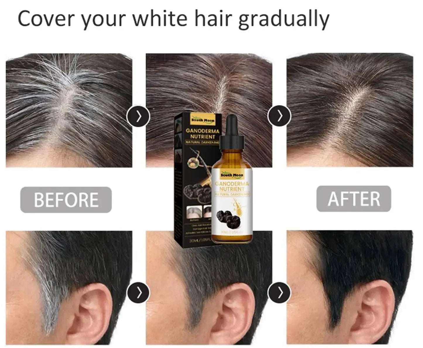 Gray White Hair Treatment Serum Liquid White To Black Natural Color Repair Nourish Products Anti Loss Hair Care for Men Women