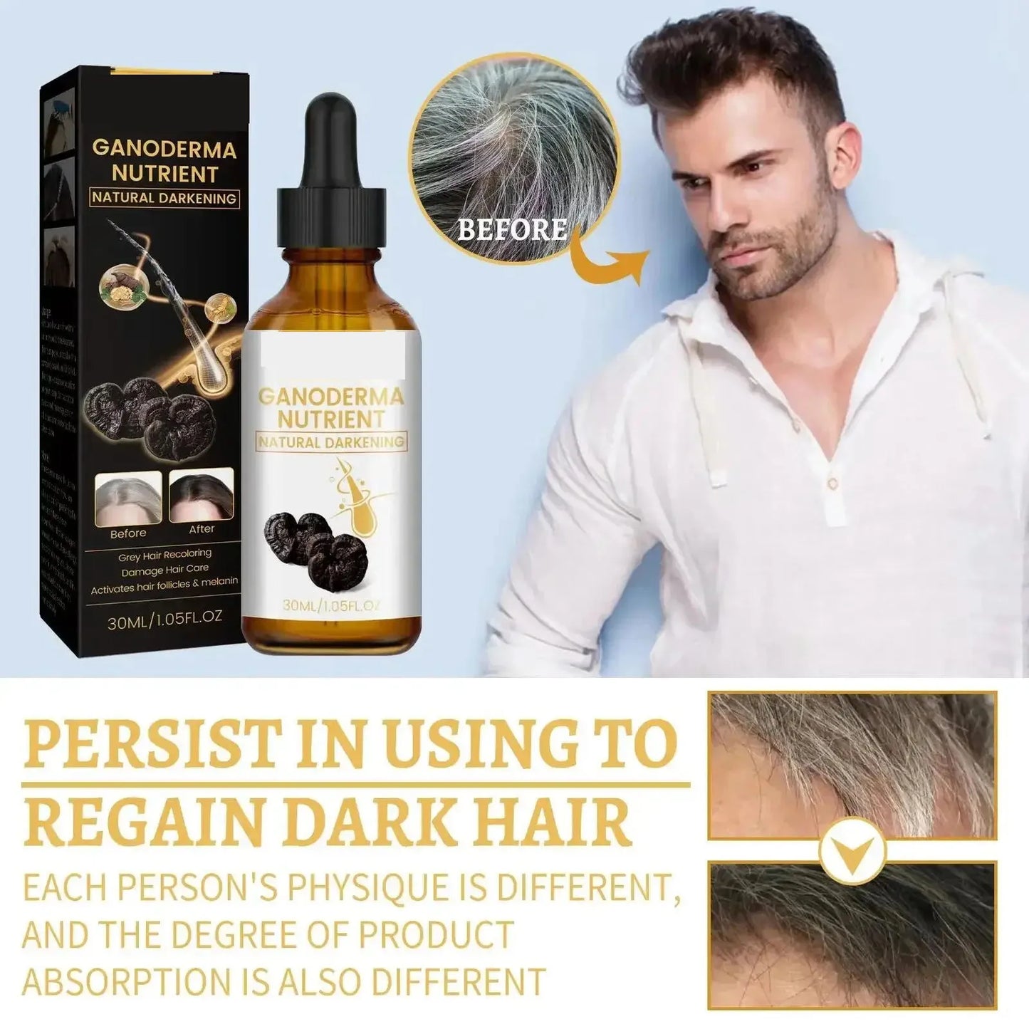 Natural Anti Gray Hair Serum | Nourishing Hair Care Remedy - Repair White & Darkening Hair