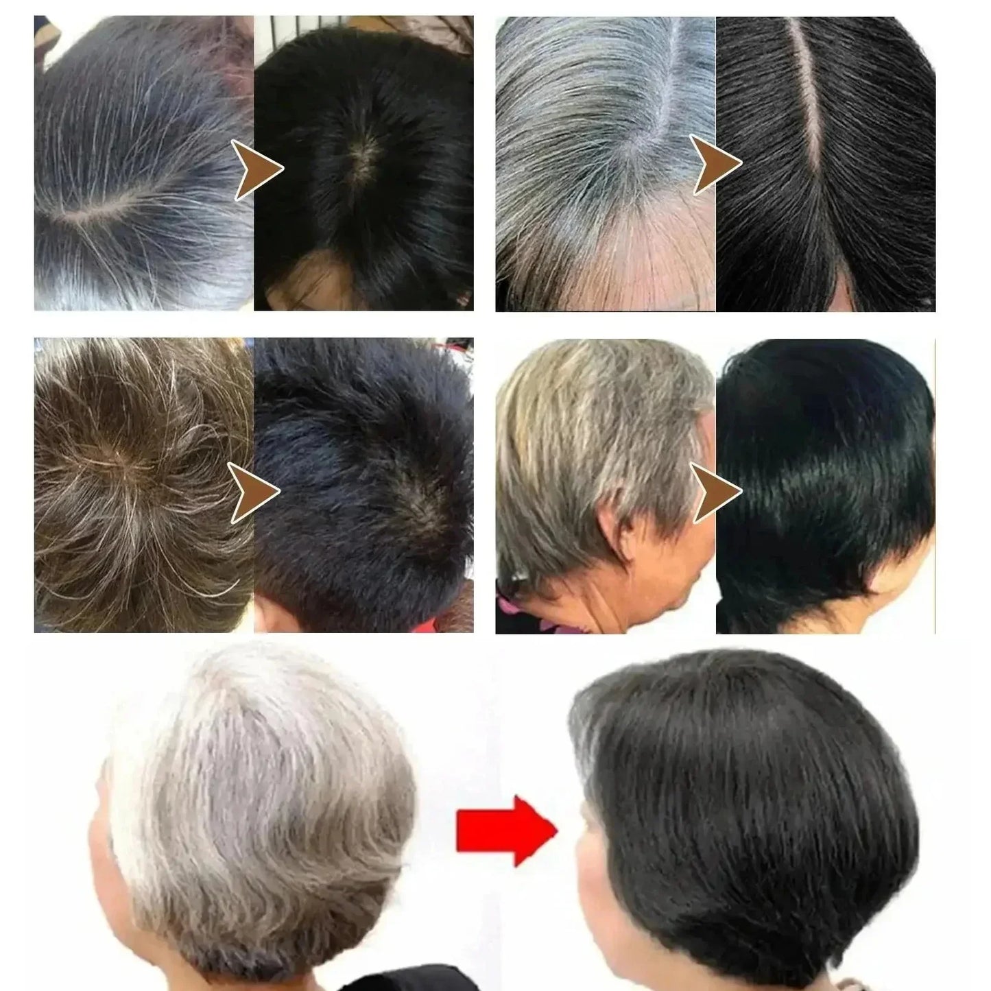 Natural Anti Gray Hair Serum | Nourishing Hair Care Remedy - Repair White & Darkening Hair