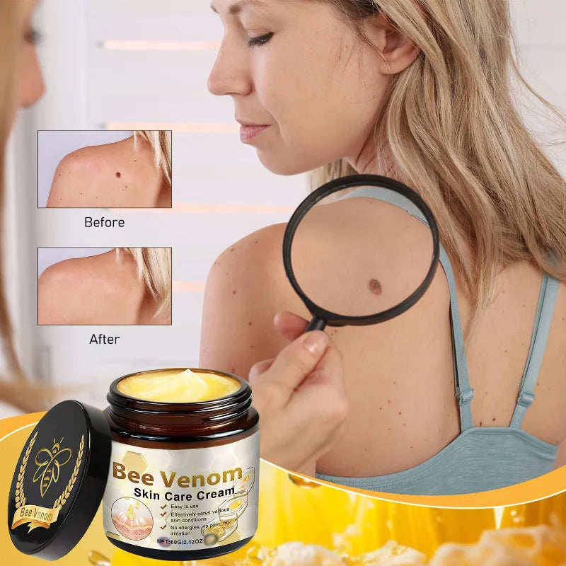 Professional Bee Venom Skin Treatment Cream Repair Gel Hydrating Moisturizing for All Skin Types(2PCS)