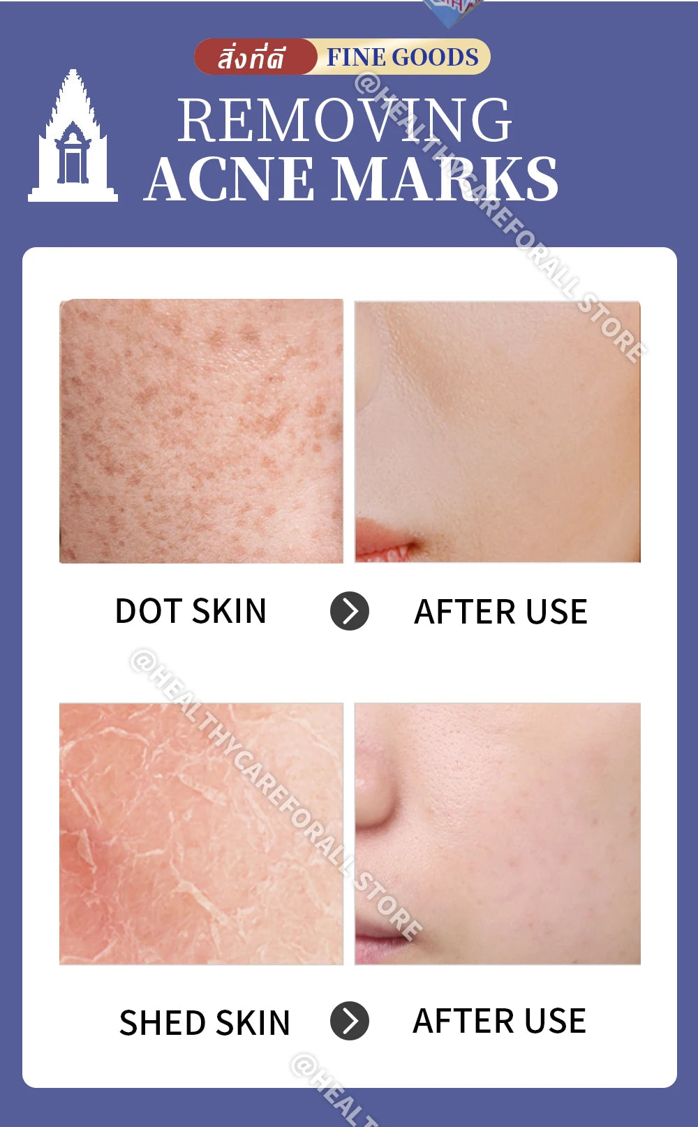 5 Pcs Ginseng Skin Revitalizer Whitening Cream Moisturizer Anti Aging Face Cream