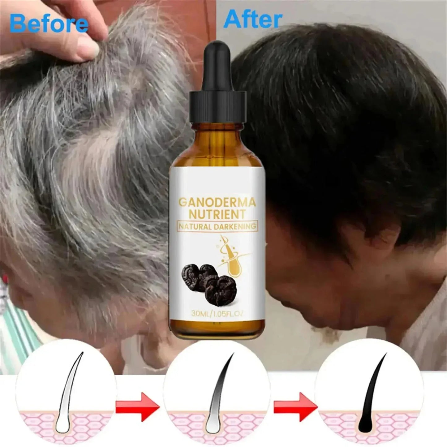 Natural Anti Gray Hair Serum | Nourishing Hair Care Remedy - Repair White & Darkening Hair
