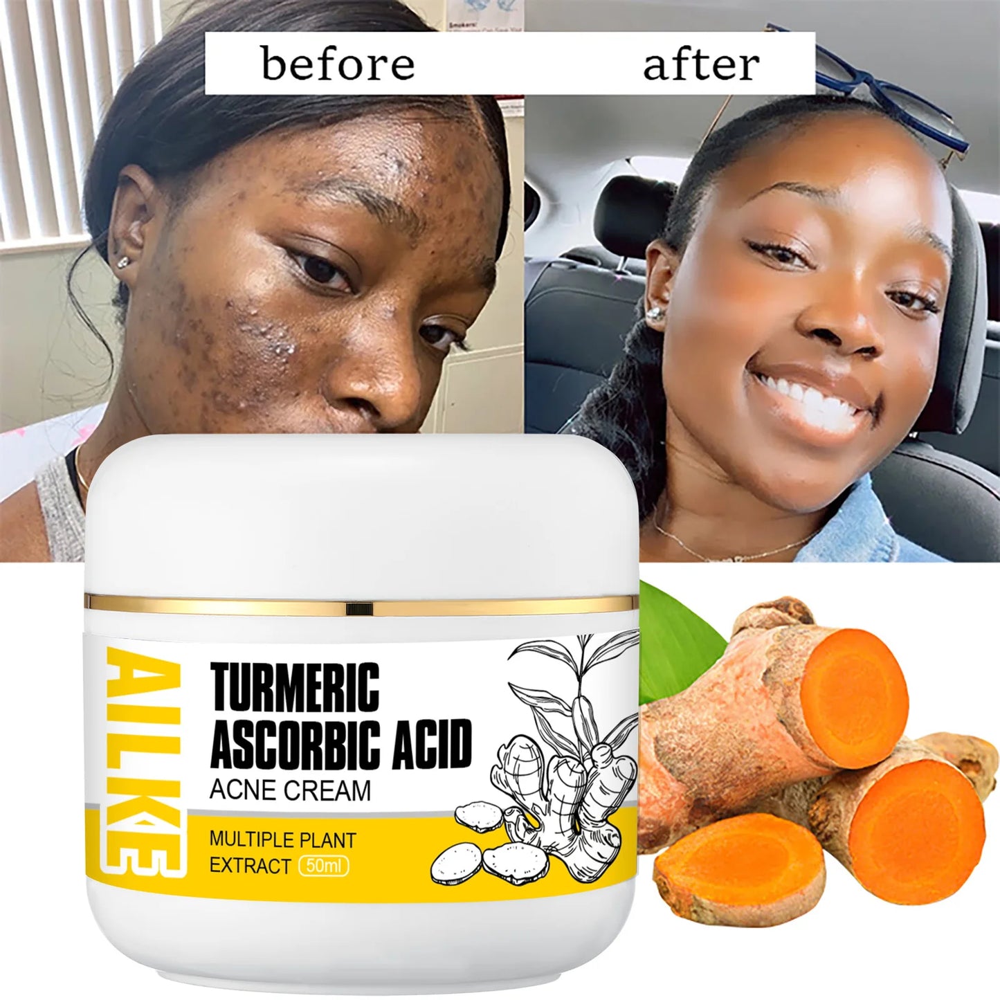 AILKE Natural Turmeric Skin Care Range, Lightening, Cleaning Skin, Moisturizes, Remove Acne and Pimples, Refining Pores