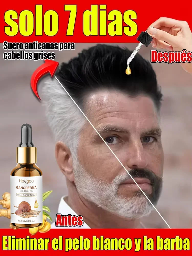 Natural antigen serum: Recover dark hair within 7 days and prevent 98% gray hair appearance - Plant extract