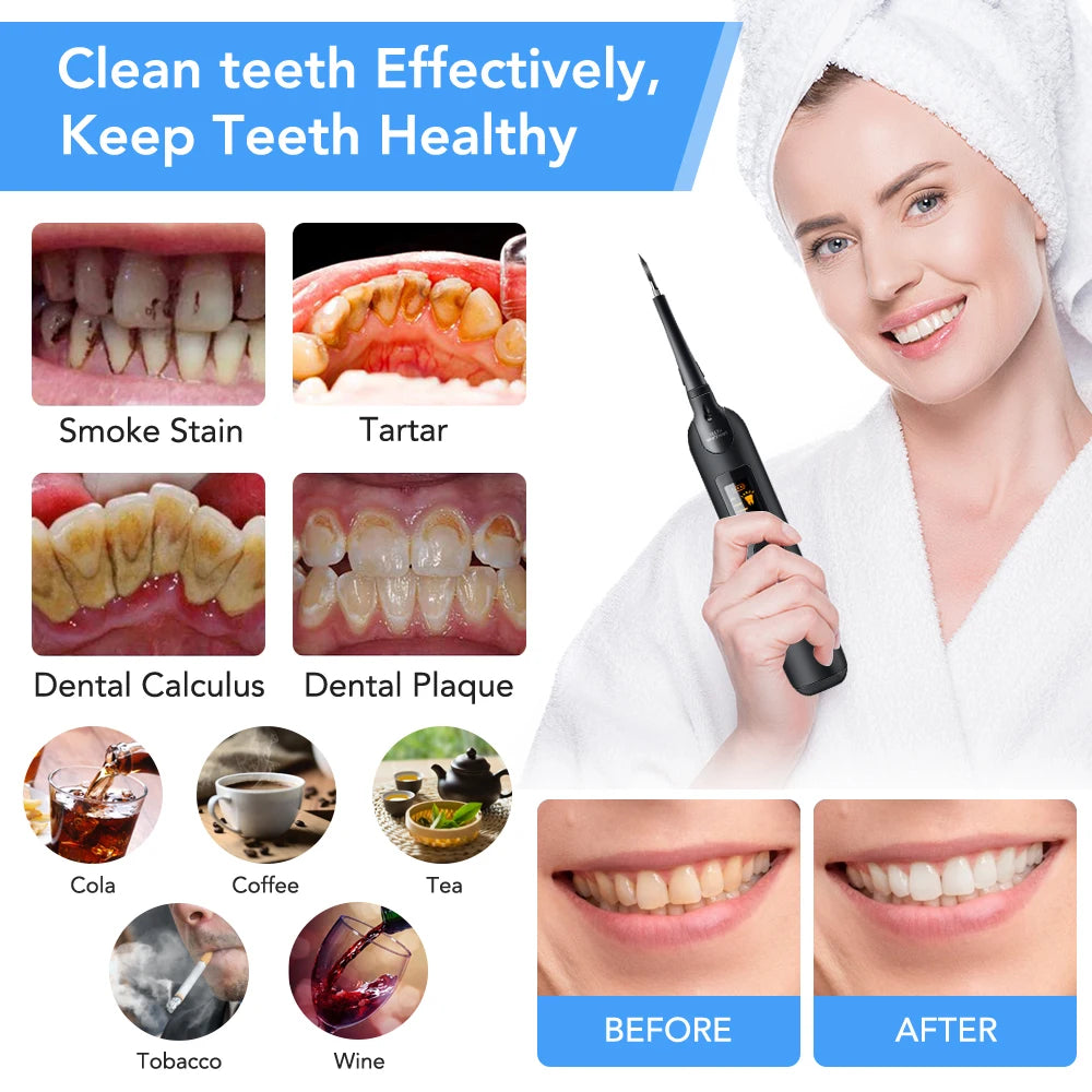 Portable Electric Sonic Dental Scaler Tooth Cleaner Calculus Stains Tartar Remover Dentist Teeth Whitening Oral Care Kit Tools