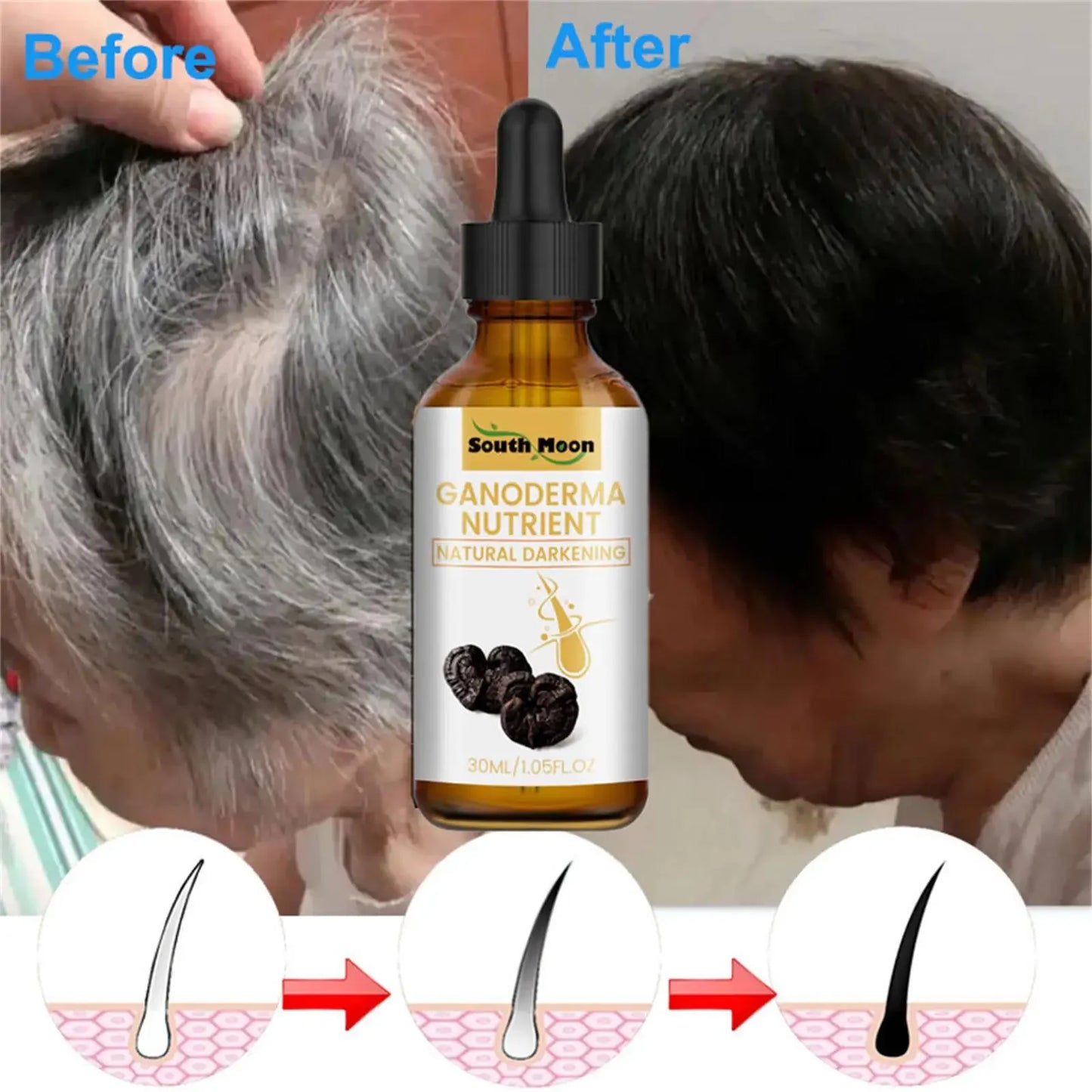 Gray White Hair Treatment Serum Liquid White To Black Natural Color Repair Nourish Products Anti Loss Hair Care for Men Women