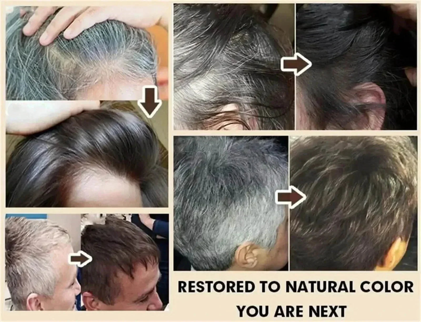 White hair killer, remove gray hair and restore natural hair color in 7 days