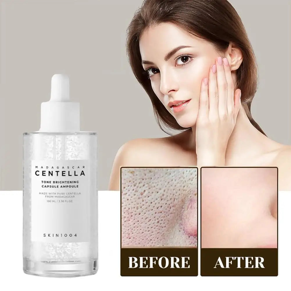 Original Skin1004 Centella Asiatica Serum Relieve Dryness Moisturizing Ampoule Essence For Sensitive Skin, Acne Skin Face Care