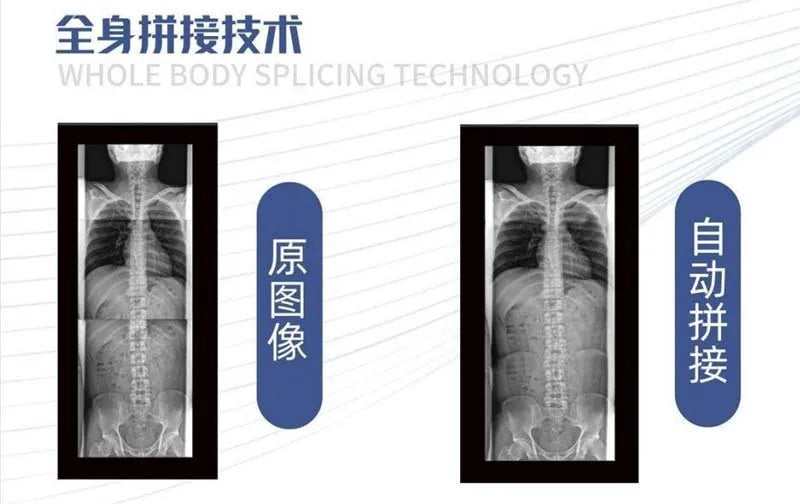 Hot Sale High Quality Scanner Price X Ray Machine Digital Radiography