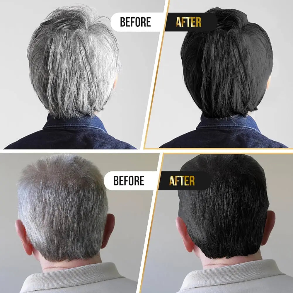 Natural Anti Gray Hair Serum | Nourishing Hair Care Remedy - Repair White & Darkening Hair