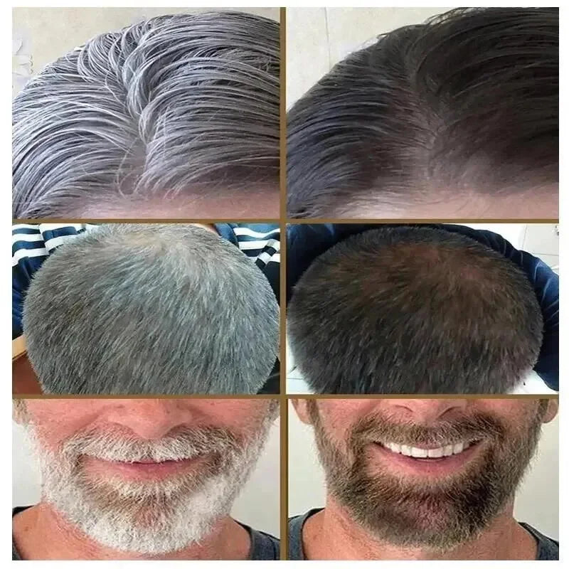 Natural Anti Gray Hair Serum | Nourishing Hair Care Remedy - Repair White & Darkening Hair
