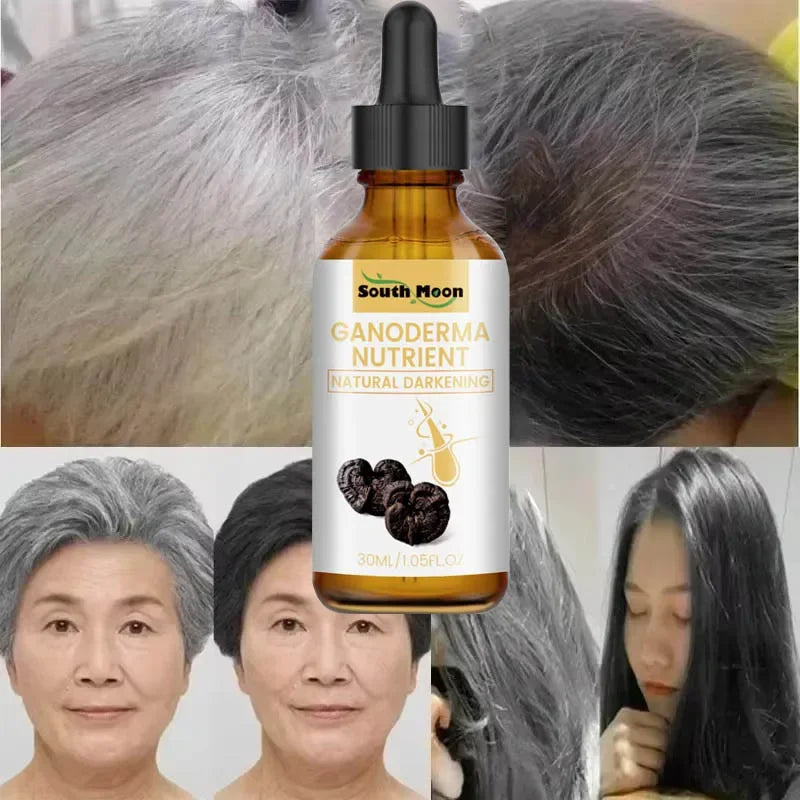 White hair killer, remove gray hair and restore natural hair color in 7 days
