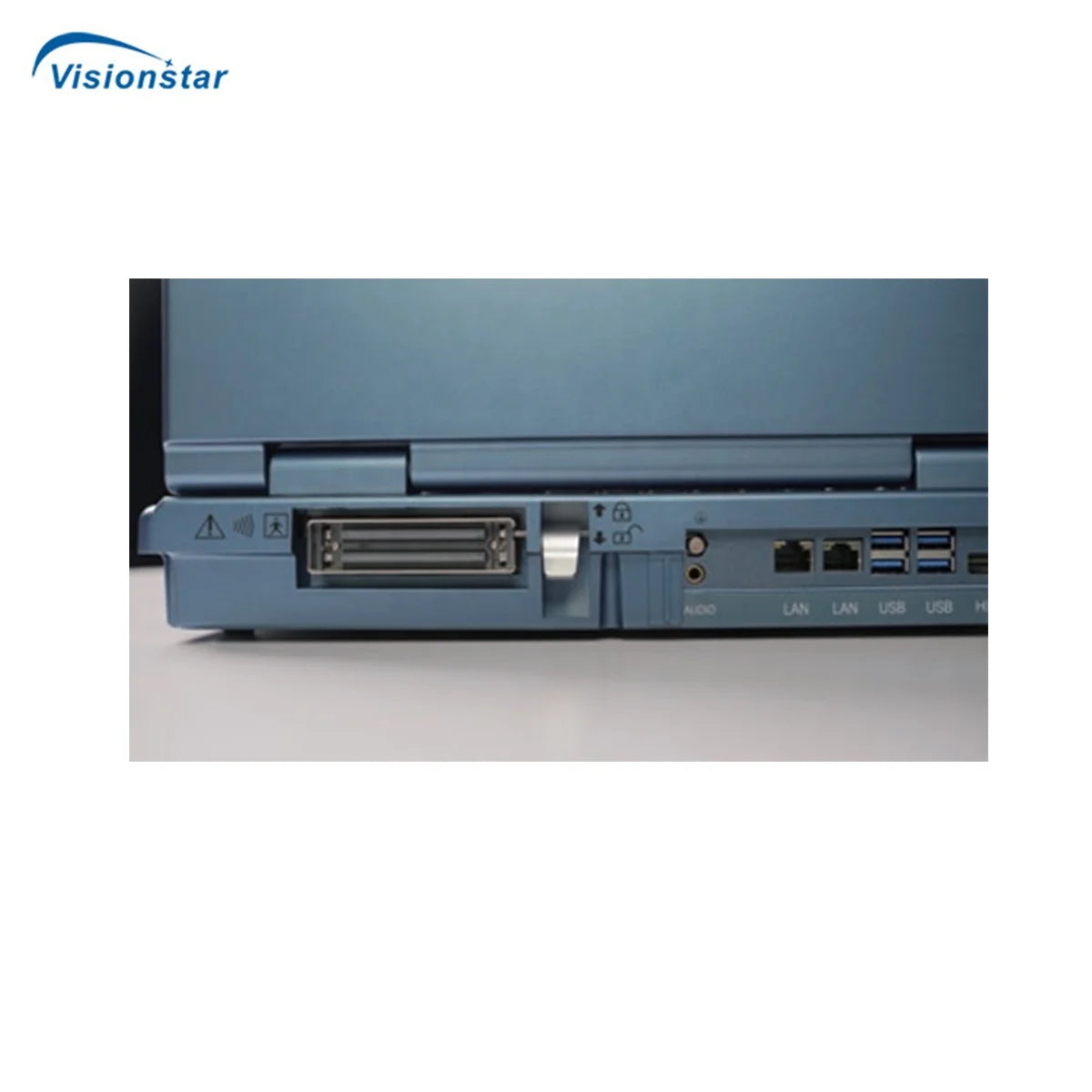 UCD5L Hospital Diagnosis Scanner Laptop Color Doppler 3D 4D Ultrasound Machine for Pregnancy