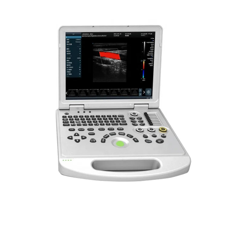 UCD5L Hospital Diagnosis Scanner Laptop Color Doppler 3D 4D Ultrasound Machine for Pregnancy
