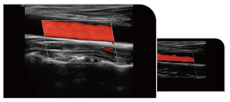 UCD5L Hospital Diagnosis Scanner Laptop Color Doppler 3D 4D Ultrasound Machine for Pregnancy