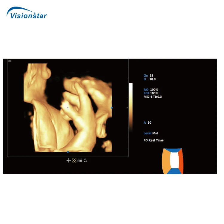 UCD60T Professional Cardiac Imaging Color Doppler 5D Trolley Ultrasound Machine for Hospital