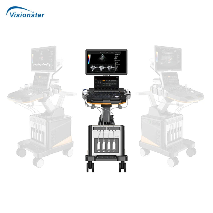UCD60T Professional Cardiac Imaging Color Doppler 5D Trolley Ultrasound Machine for Hospital