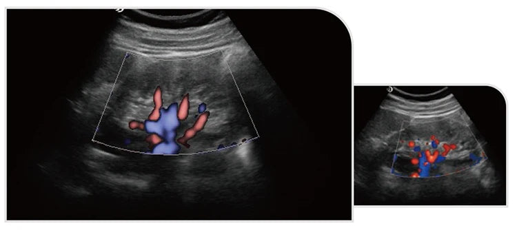 UCD5L Hospital Diagnosis Scanner Laptop Color Doppler 3D 4D Ultrasound Machine for Pregnancy