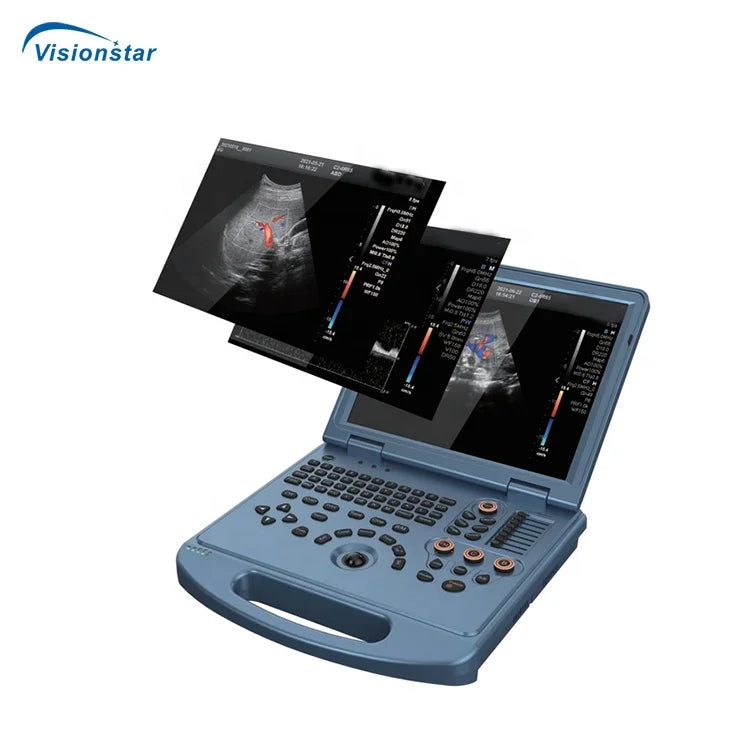 UCD5L Hospital Diagnosis Scanner Laptop Color Doppler 3D 4D Ultrasound Machine for Pregnancy