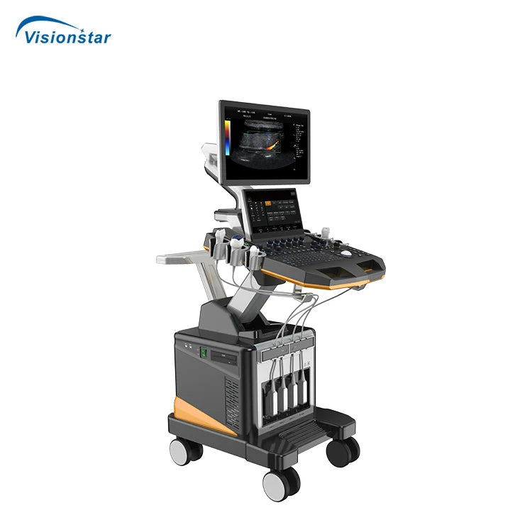 UCD60T Professional Cardiac Imaging Color Doppler 5D Trolley Ultrasound Machine for Hospital