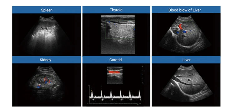 UCD5L Hospital Diagnosis Scanner Laptop Color Doppler 3D 4D Ultrasound Machine for Pregnancy