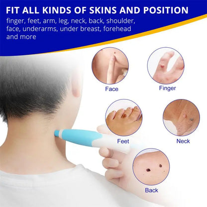 2 In1 Painless Auto Skin Tag Mole Wart Removal Kit Cleaning Tools Face Skin Care Body Wart Dot Treatments Remover Beauty Health