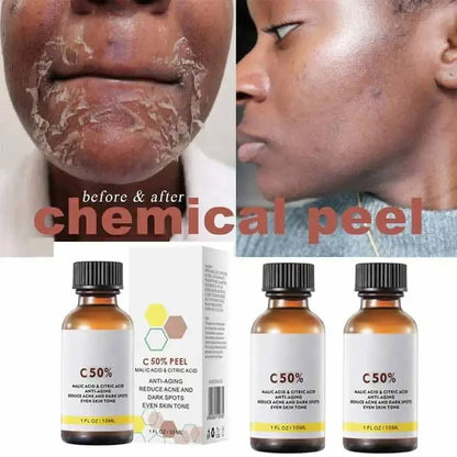 Exfoliating Peeling Oil Facial Scrub Moisturizing Whitening Nourishing Repair Beauty Skin Care Peeling Facial Essence