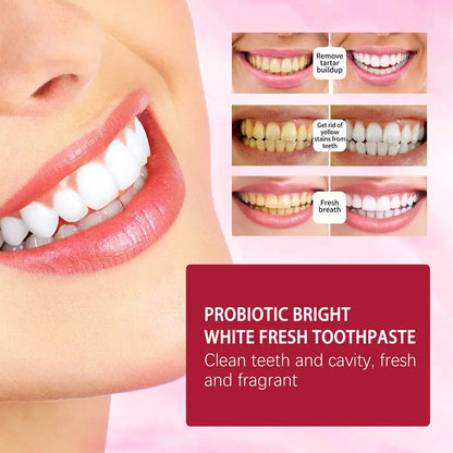 120g SP-4 Probiotic Whitening Shark Toothpaste Teeth Whitening Toothpaste Oral Care Toothpaste Fresh Breath Prevents Plaque