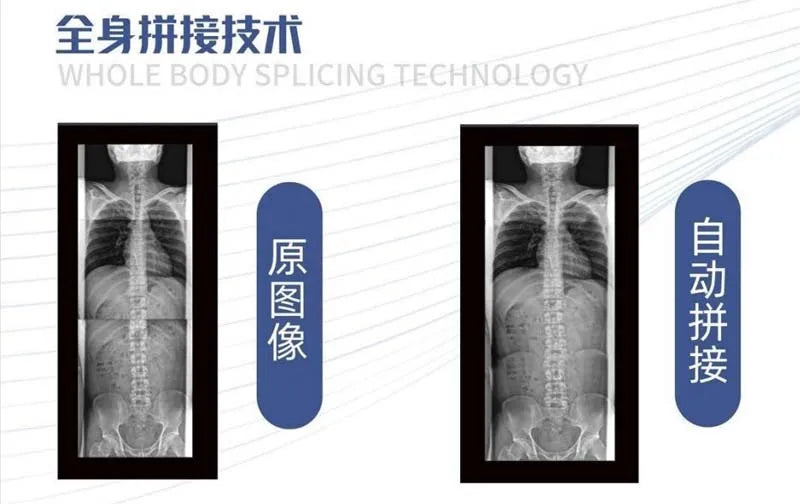 Hot Sale High Quality Scanner Price X Ray Machine Digital Radiography