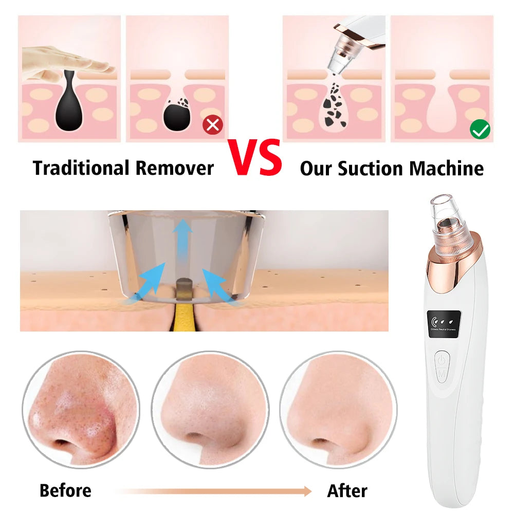 Blackhead Remover Vacuum Pore Cleaner Face Cleaning and Exfoliating Black Dots Acne Pimple Removal Beauty Machine Skin Care Tool