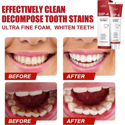 Probiotic Toothpaste freshen breath maintain oral health whiten teeth Stain Removing Sp-4 Toothpaste Teeth Cleaner Plaque Remove