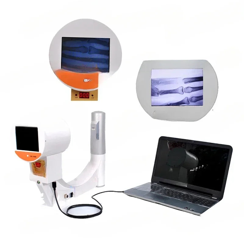 Portable X-Ray, Fluoroscopy MSLPX32