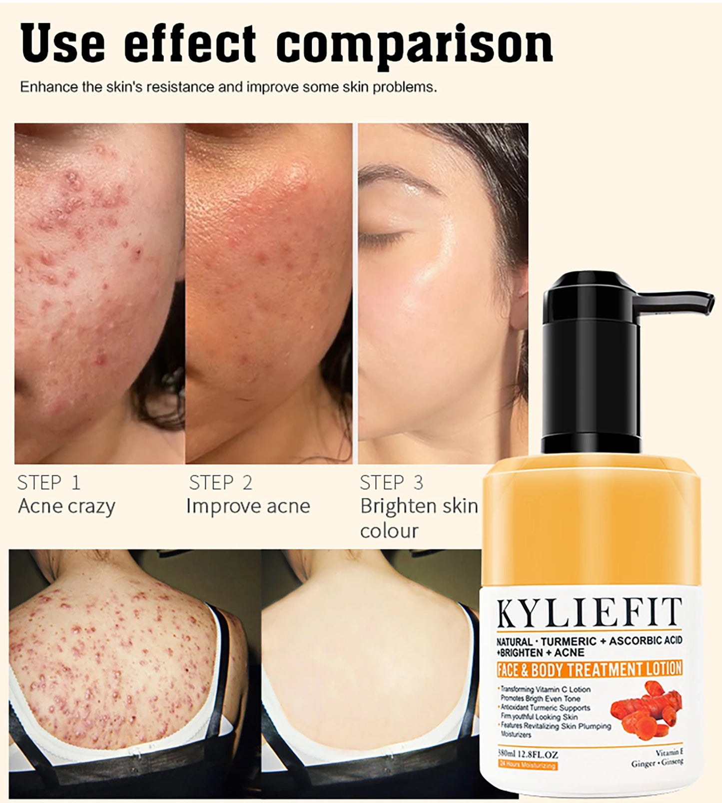 AILKE Natural Turmeric Skin Care Range, Lightening, Cleaning Skin, Moisturizes, Remove Acne and Pimples, Refining Pores